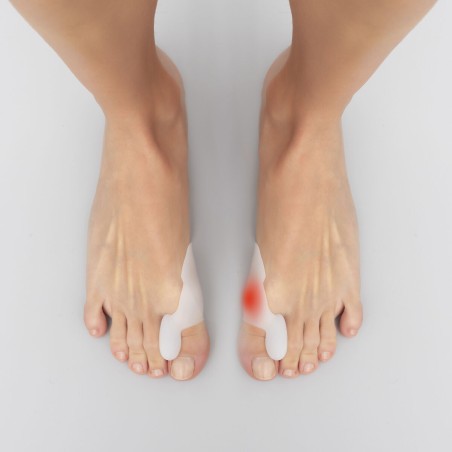Correttore Protezione in Silicone per Alluce Valgo Bunilief InnovaGoods 2 Unità